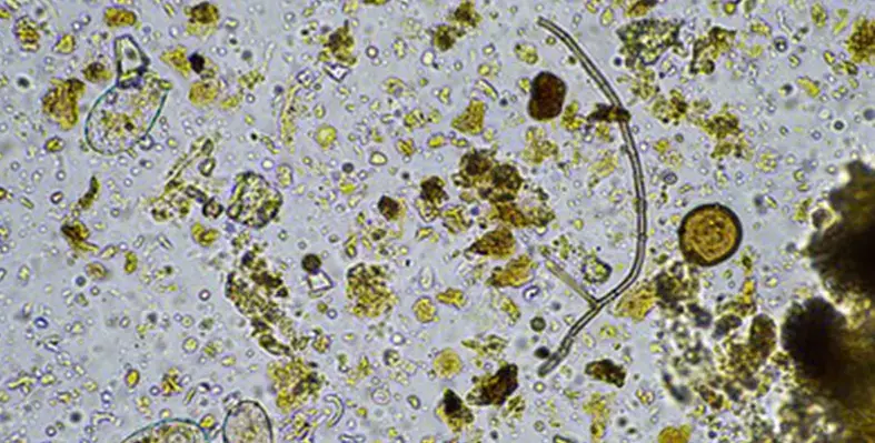 image_shows_microorganisms_under_a_microscope_indicating_the discovery_of_naturally_occurring_herbicides